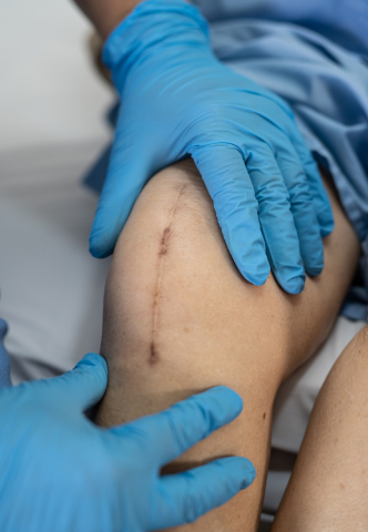 Surgical Wounds